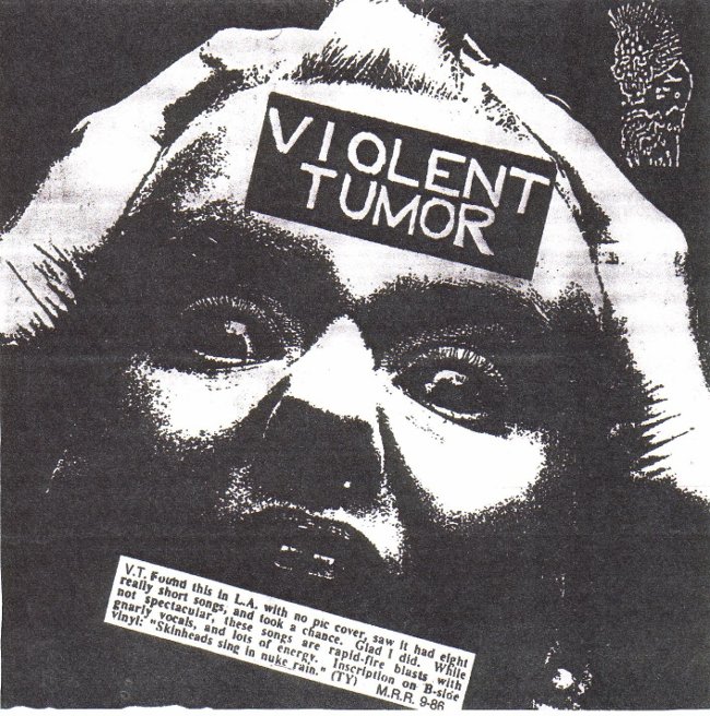 Violent Tumor-7A.jpg